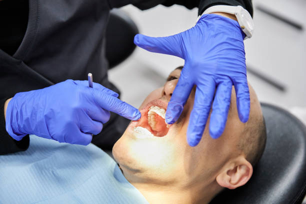 Best Emergency Treatment for Toothache in Mansfield, AR