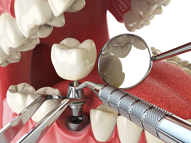 Best Emergency Treatment for Toothache in Mansfield, AR